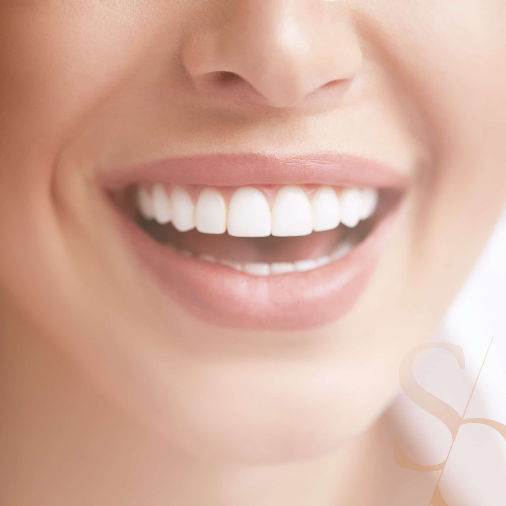 Esthétique du sourire | Solutions | Clinique dentaire Sana Oris Paris 8