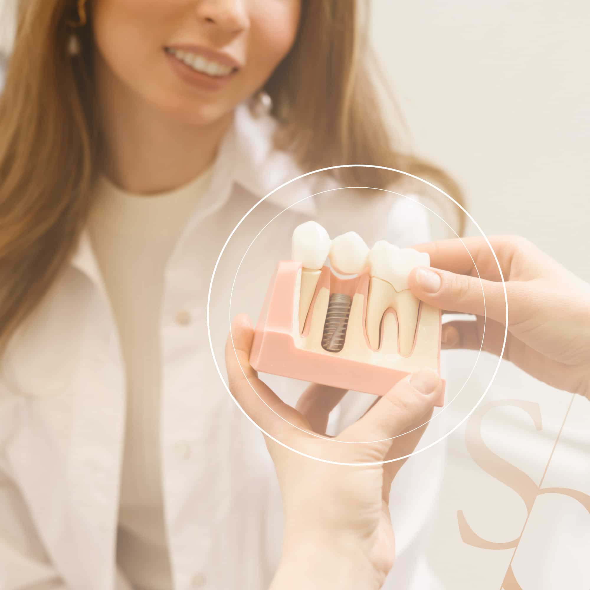 Implants dentaires | Chirurgie dentaire | Clinique Sana Oris | Paris 8