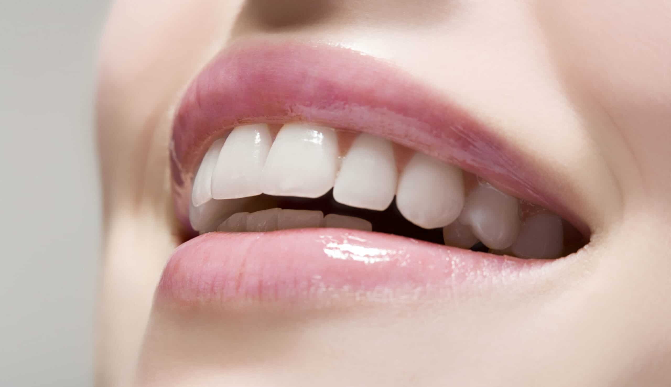 Dents abîmées : comment retrouver le sourire ? | Clinique dentaire Sana Oris | Paris 8