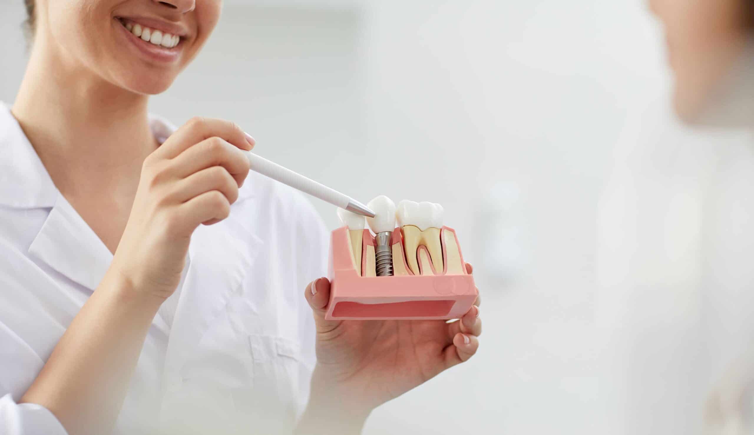 Quelle est la durée de vie d’un implant dentaire ? | Clinique dentaire Sana Oris | Paris 8