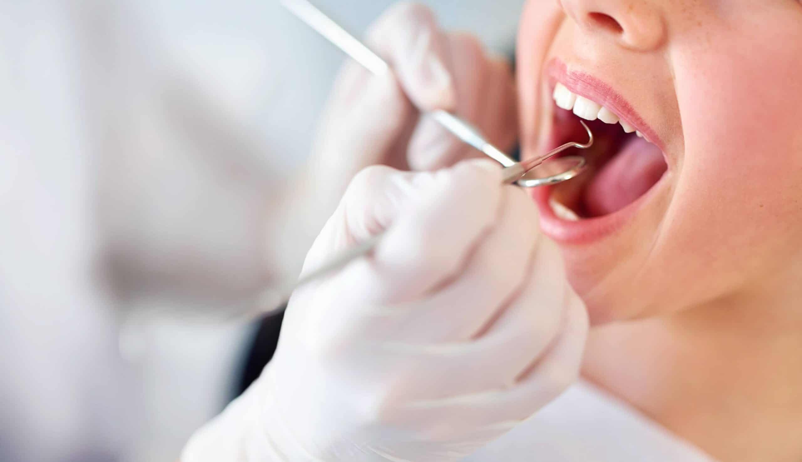 Qu’est-ce qu’un endodontiste ? | Clinique dentaire Sana Oris | Paris 8