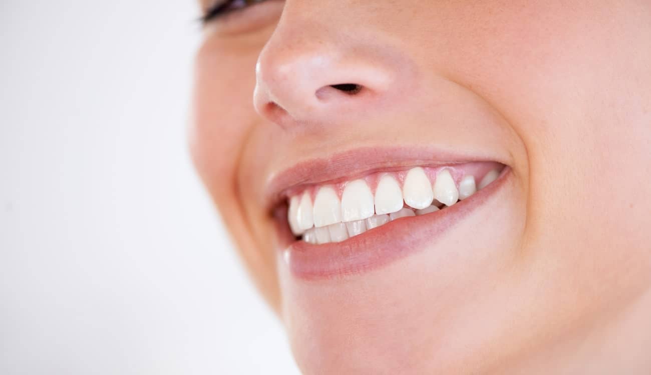 Quelle est la différence entre une facette dentaire et une couronne dentaire ? | Clinique dentaire Sana Oris | Paris 8