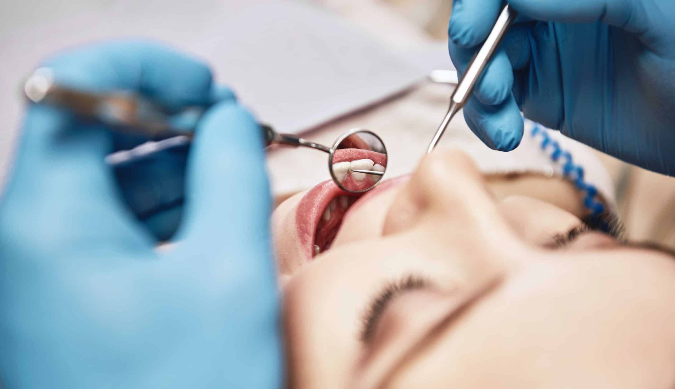 Quelle est la différence entre un dentiste et un endodontiste ? | Clinique dentaire Sana Oris | Paris 8