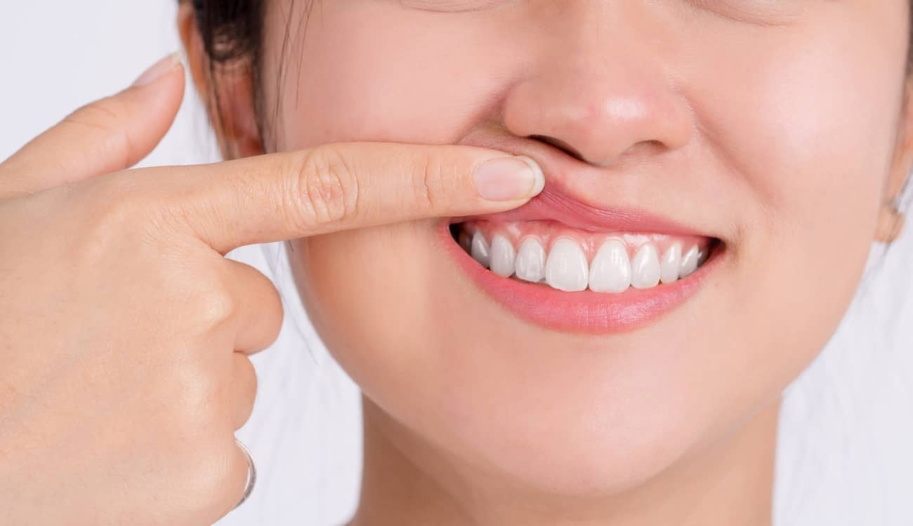 Comment savoir si j’ai une gingivite ? | Clinique dentaire Sana Oris | Paris 8