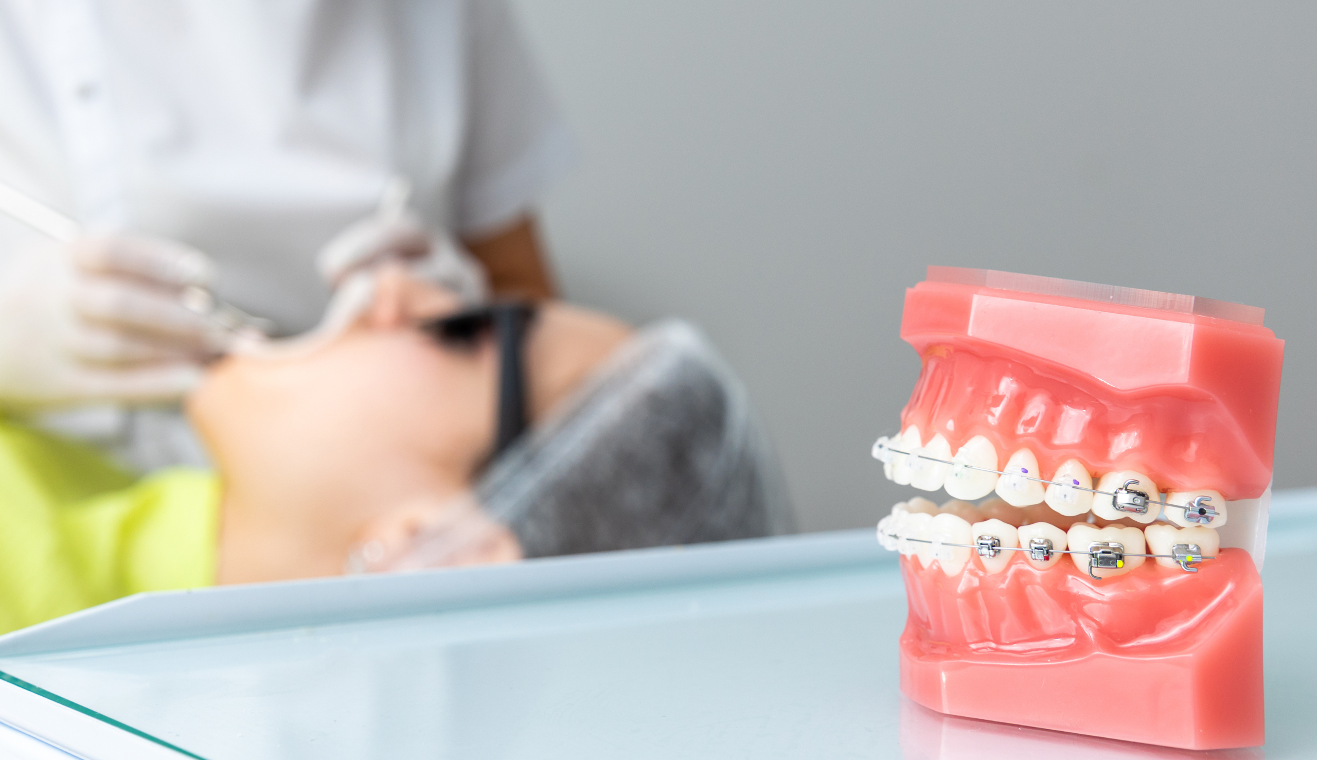 Quels sont les conséquences d'un mauvais alignement dentaire ? | Clinique dentaire Sana Oris | Paris