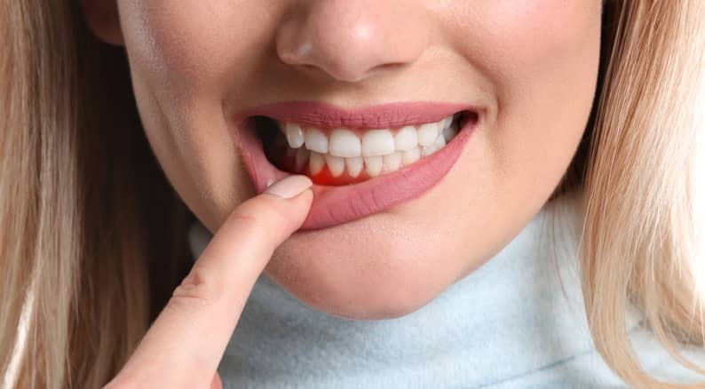 Comment soigner une inflammation de la gencive ? | Clinique dentaire Sana Oris | Paris 8
