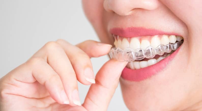 Le traitement orthodontique Invisalign est-il adapté à tout le monde ? | Clinique dentaire Sana Oris | Paris 8